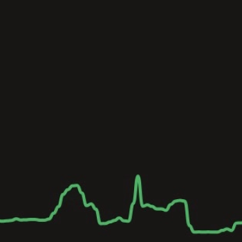 The line from the line graph of my investments.